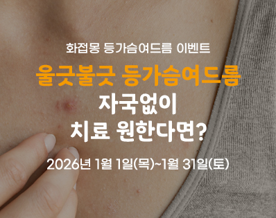 등가슴여드름_이벤트
