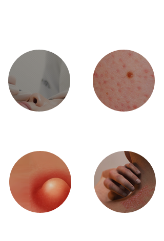 발효약초테라피